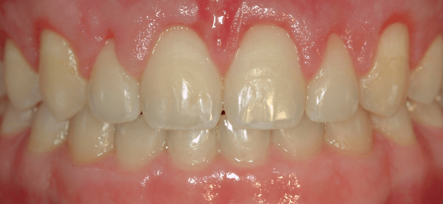 Periodontal Center of Excellence Dental Implant Center Periodontal Center of Excellence Dental Implant Center