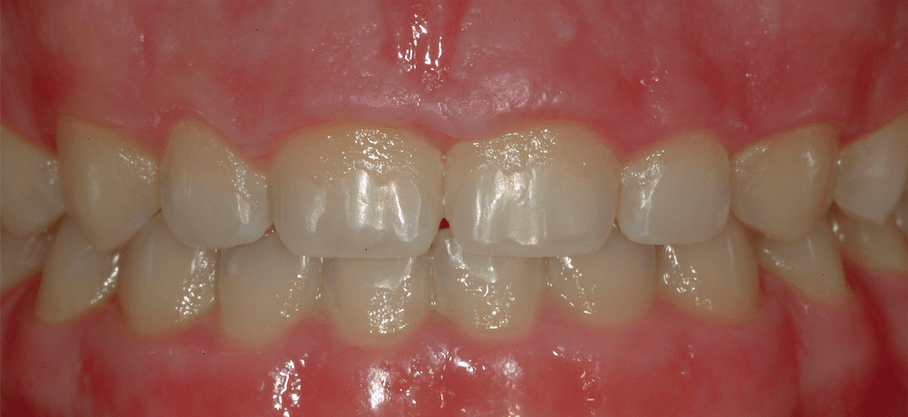 Periodontal Center of Excellence Dental Implant Center Periodontal Center of Excellence Dental Implant Center