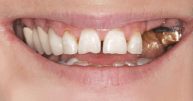 Periodontal Center of Excellence Dental Implant Center